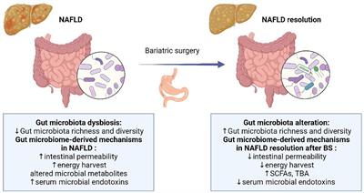 Gut microbiome and microbial metabolites in NAFLD and after bariatric surgery: Correlation and causality